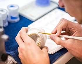 Boca Raton dental implant dentist designing dental implant supported dentures