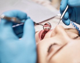 Dentist using dental mirror to look at the back of patient's teeth