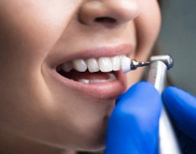 Closeup of dental hygienist polishing smiling patient's teeth