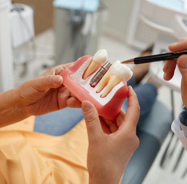 Dentist showing a model of a dental implant to a patient