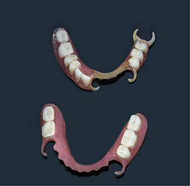 Two partial dentures