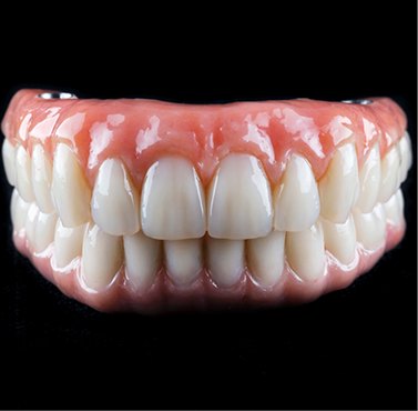 Set of implant dentures