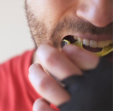 Man placing a mouthguard over his teeth
