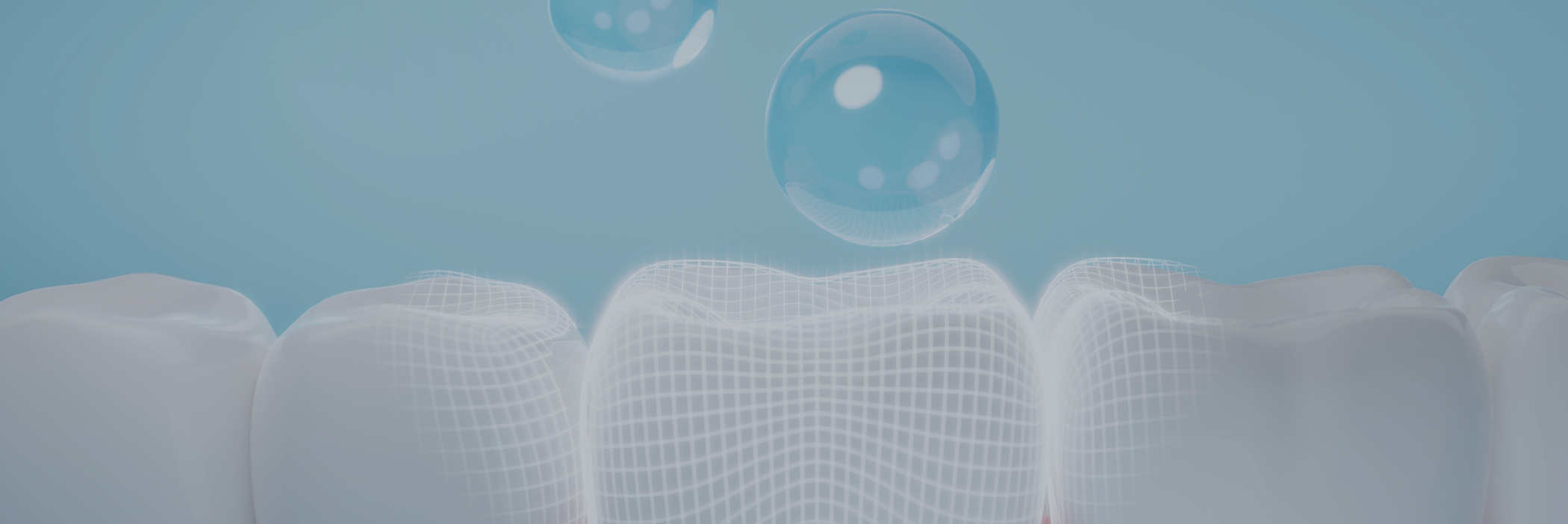 Illustration of the teeth after fluoride treatment