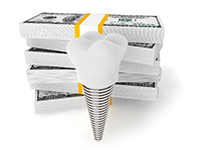 Model implant and money stacks representing cost of dental implants in Boca Raton 