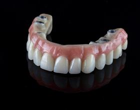 Implant denture for upper arch against black background