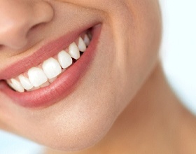 Woman with white smile after teeth whitening in Boca Raton