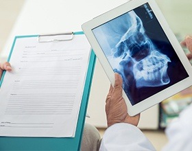 X-ray of jaw and skull used to plan treatment with a TENS machine