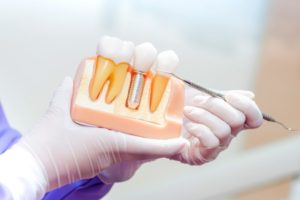 Dentist explaining value of dental implants in Boca Raton