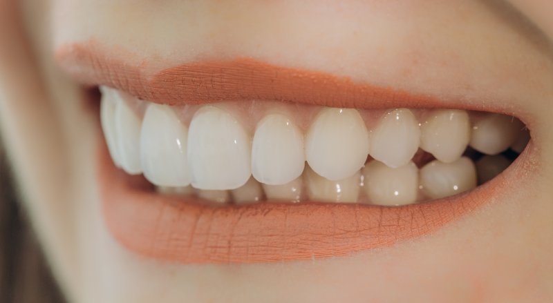 Woman with dental veneers in Boca Raton