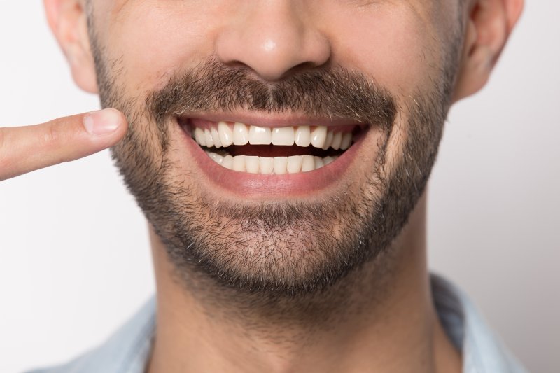 man smiling and pointing at teeth in Boca Raton