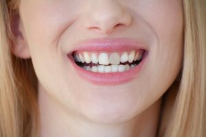 a woman smiling and revealing her gray tooth